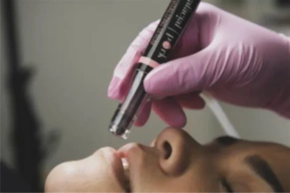 Hydra Lip