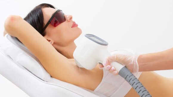 Laser Hair Removal