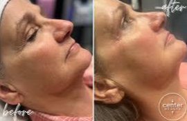 Imgi 4 66199e58660f5a000f0a0611 Optimized