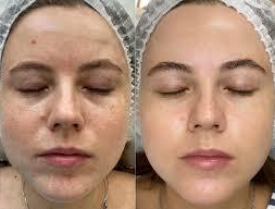 Imgi 4 66199e58660f5a000f0a0611 Optimized 987