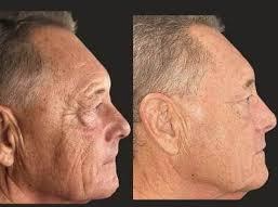 Imgi 4 66199e58660f5a000f0a0611 Optimized 987