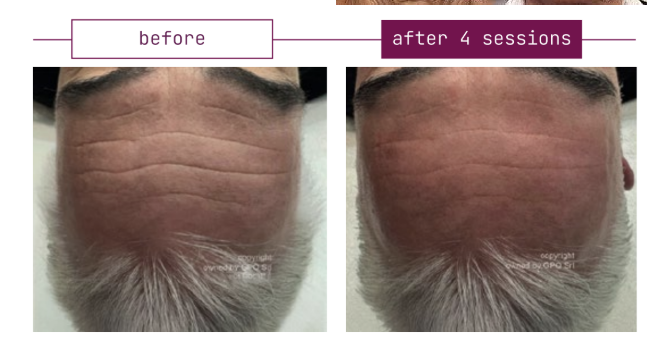 Imgi 5 66199cc9fd942c000f46f91b Optimized 926