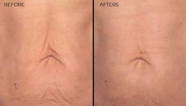 Imgi 5 66199cc9fd942c000f46f91b Optimized 926