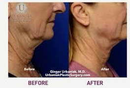 Imgi 5 66199cc9fd942c000f46f91b Optimized 926