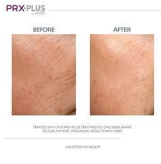 Imgi 4 66199e58660f5a000f0a0611 Optimized