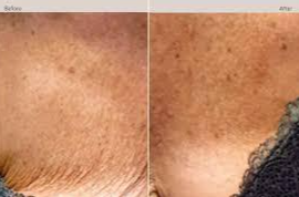 Imgi 4 66199e58660f5a000f0a0611 Optimized