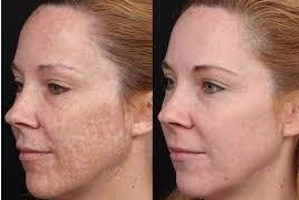 Imgi 4 66199e58660f5a000f0a0611 Optimized