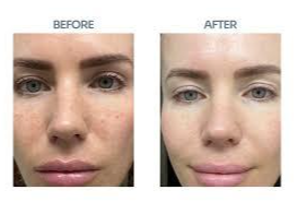 Imgi 4 66199e58660f5a000f0a0611 Optimized 987