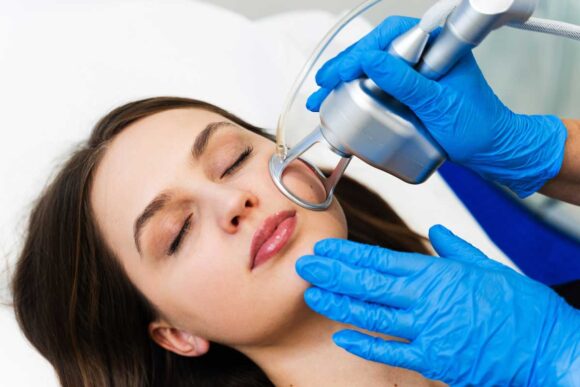 Skin Resurfacing