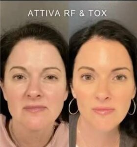 Beforeandafter11