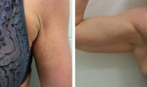 Beforeandafter2