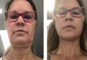 Beforeandafter3