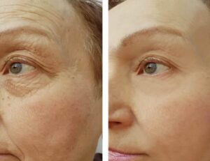 Beforeandafter4