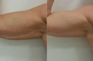 Beforeandafter6