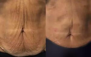 Beforeandafter7