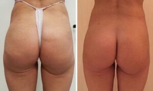 Beforeandafter8