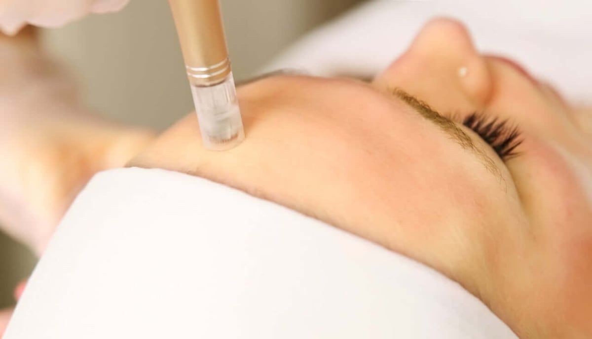 Revitalize Your Skin: The Magic of SkinPen Microneedling in New Providence