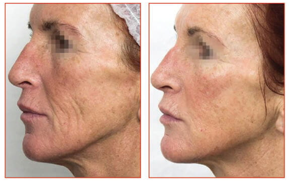 Imgi 4 66199e58660f5a000f0a0611 Optimized