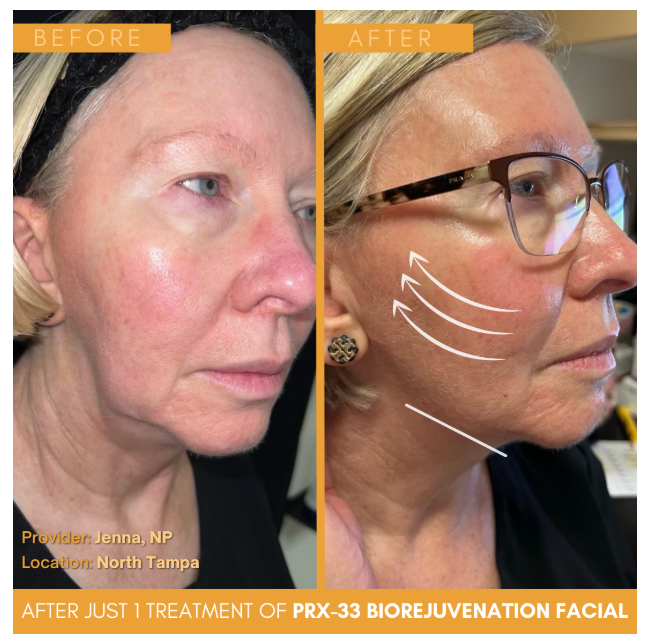 Imgi 4 66199e58660f5a000f0a0611 Optimized