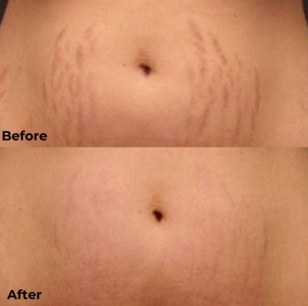 Imgi 5 66199cc9fd942c000f46f91b Optimized 926