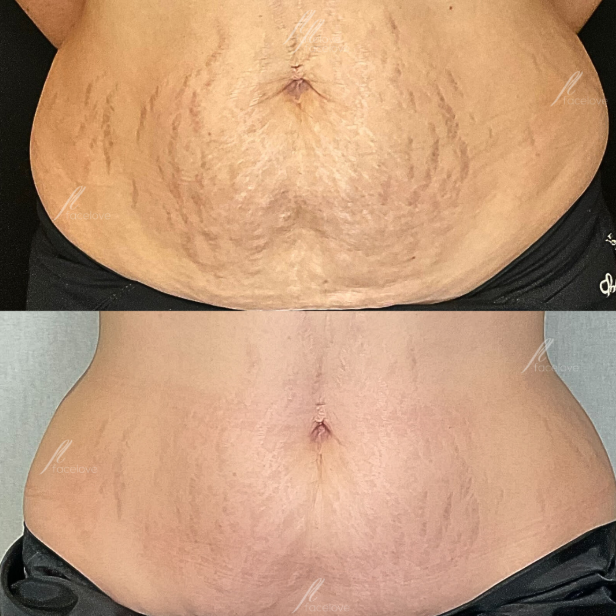 Imgi 5 66199cc9fd942c000f46f91b Optimized 926