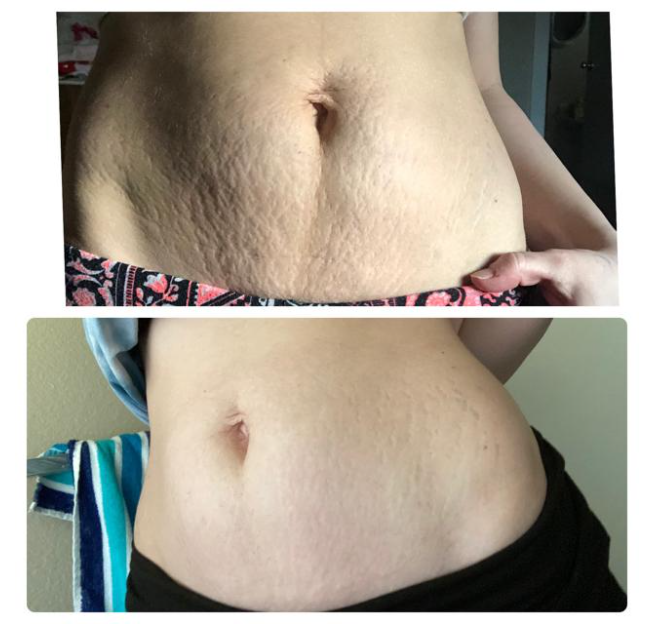 Imgi 5 66199cc9fd942c000f46f91b Optimized 926