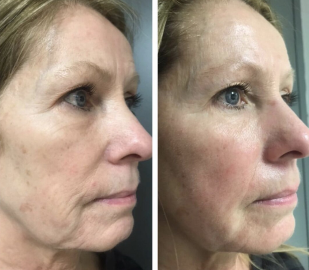 Imgi 4 66199e58660f5a000f0a0611 Optimized