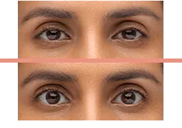Imgi 4 660cdef86c2982000f9aa110 Optimized